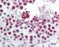ATF6 Antibody (C-Terminus)